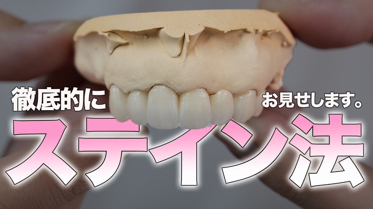 【歯科技工士】徹底的にステイン法お見せします！