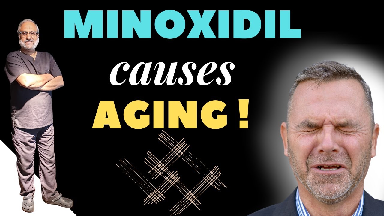 Minoxidil for Hair Loss | Side Effects