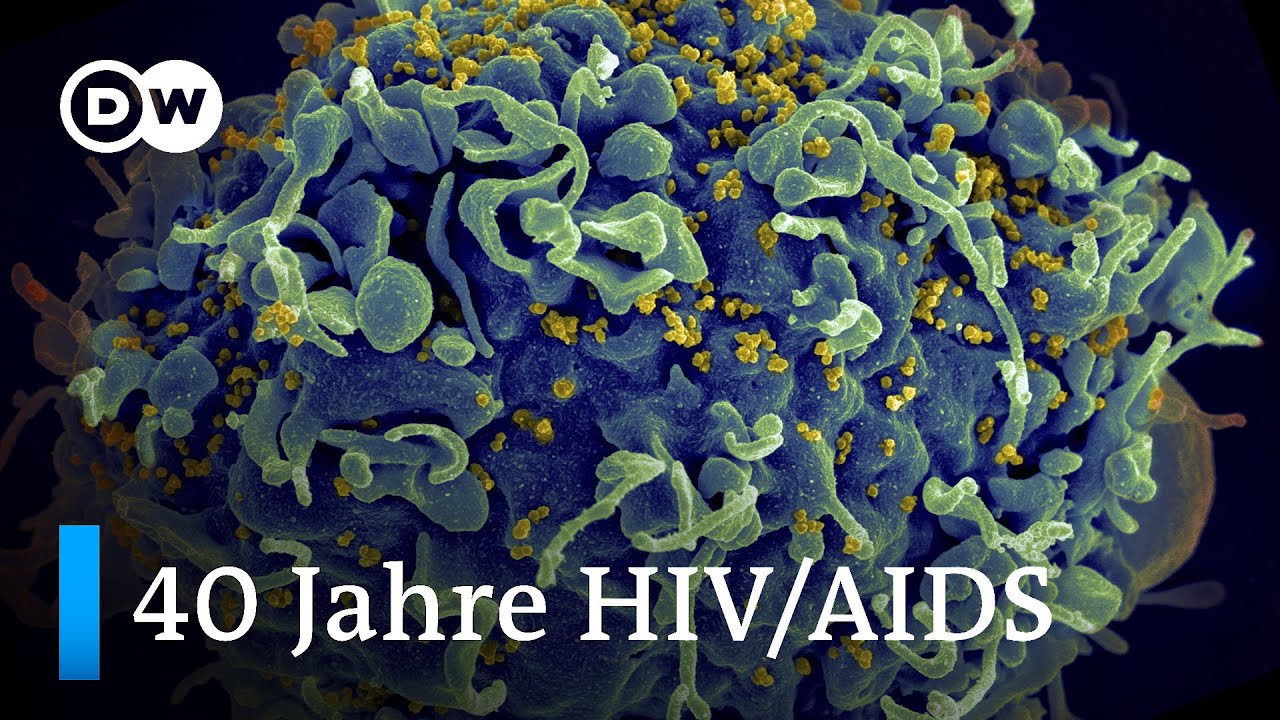 40 Jahre HIV/AIDS und noch immer kein Impfstoff, wieso? | DW Nachrichten
