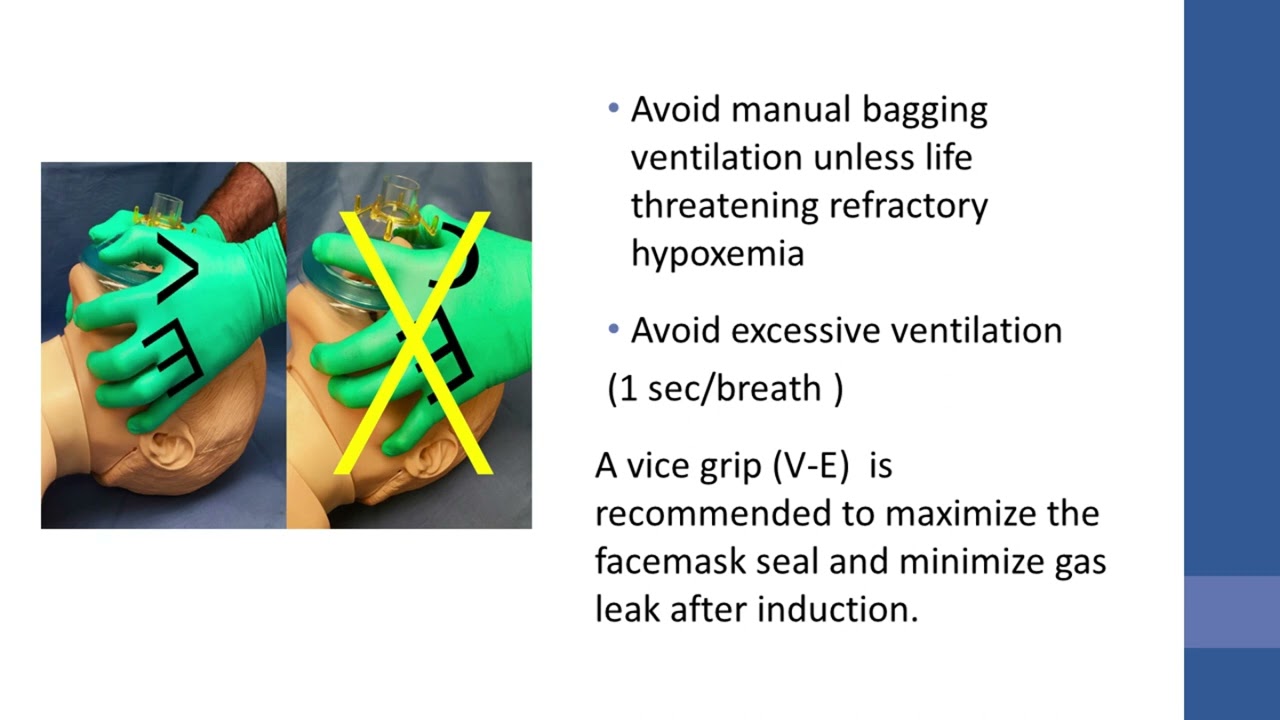 4 Cardiopulmonary Resuscitation CPR Management