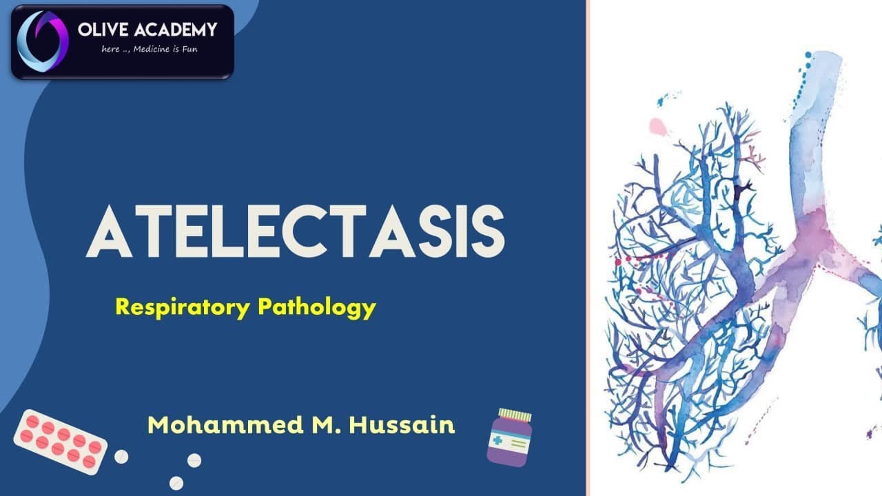 RS   Patho TBL1 Part 1   Atelectasis
