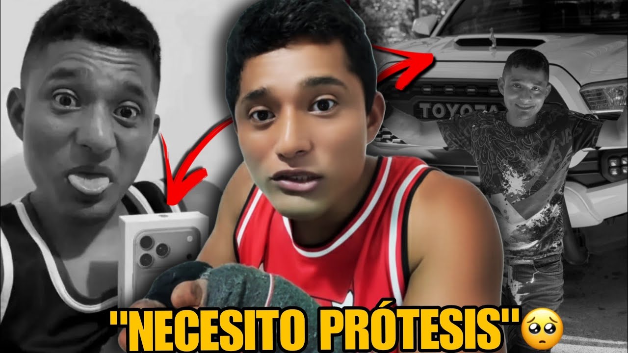 Este TIKTOKER ENGAÑÓ a sus SEGUIDORES USANDO su DISCAPACIDAD