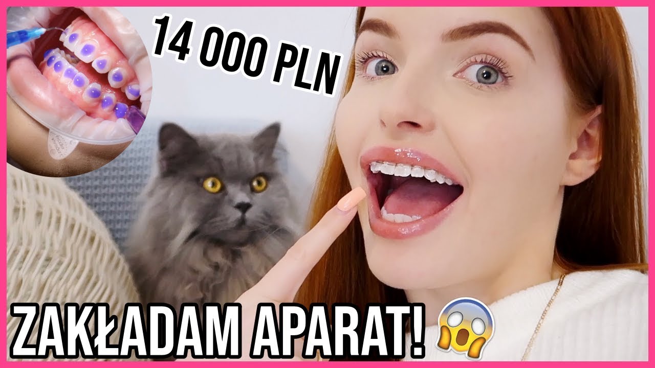 ZAKŁADAM APARAT ORTODONTYCZNY! CZYLI JAK OSZPECIĆ SIĘ ZA 14 000 ZŁ W 15 MINUT