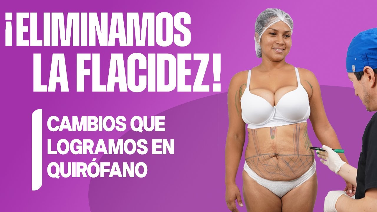 ¡ELIMINAMOS LA FLACIDEZ! CAMBIOS QUE LOGRAMOS EN QUIRÓFANO