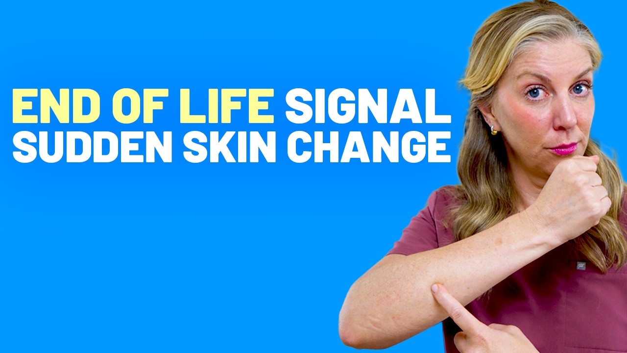 This Skin Change Can Mean Days Left to Live