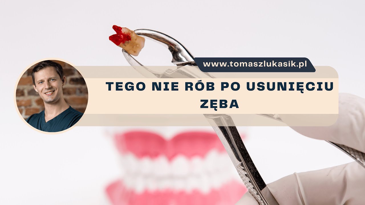 Miałeś usuwany ząb? Rzeczy, które musisz wiedzieć, aby uniknąć komplikacji!