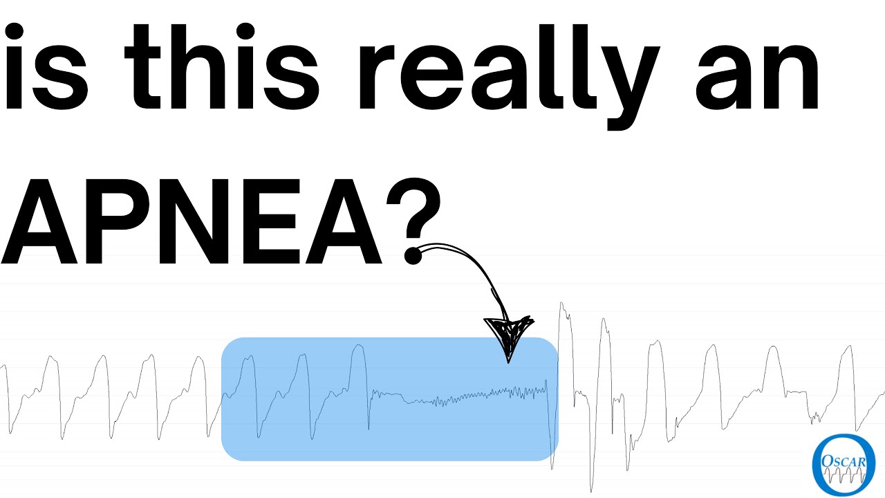 Sleep Apnea: A Closer Look at Individual Breaths