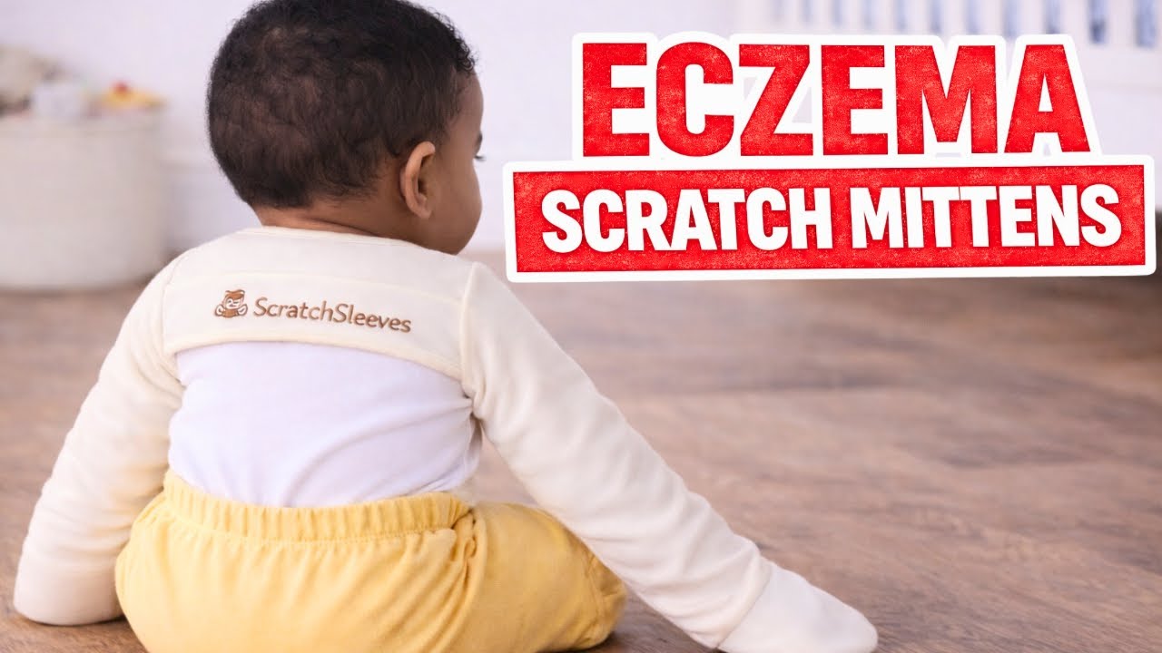 Do Scratch Sleeves Help Baby Eczema?