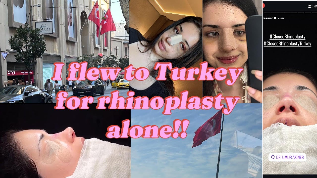 I flew from Sydney to Turkey for closed Rhinoplasty alone?? Is it worth it? Dr Umur Akiner