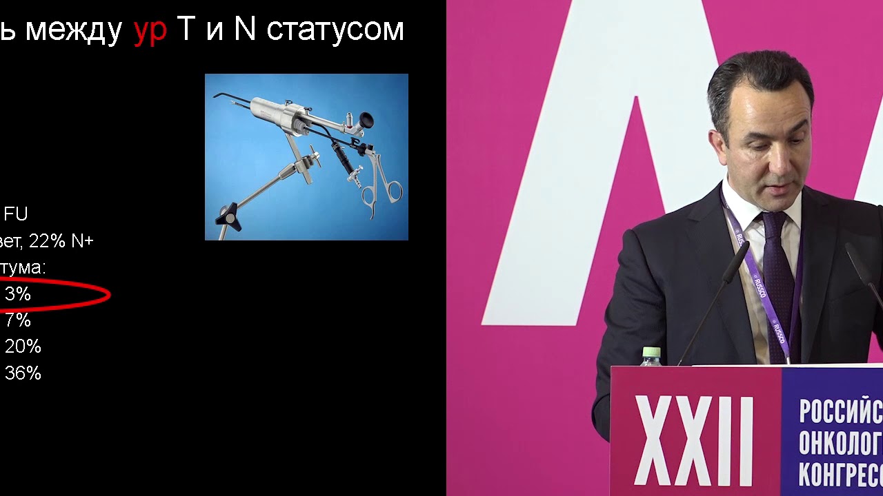 Рак прямой кишки Т2NхM0. Комбинированное лечение