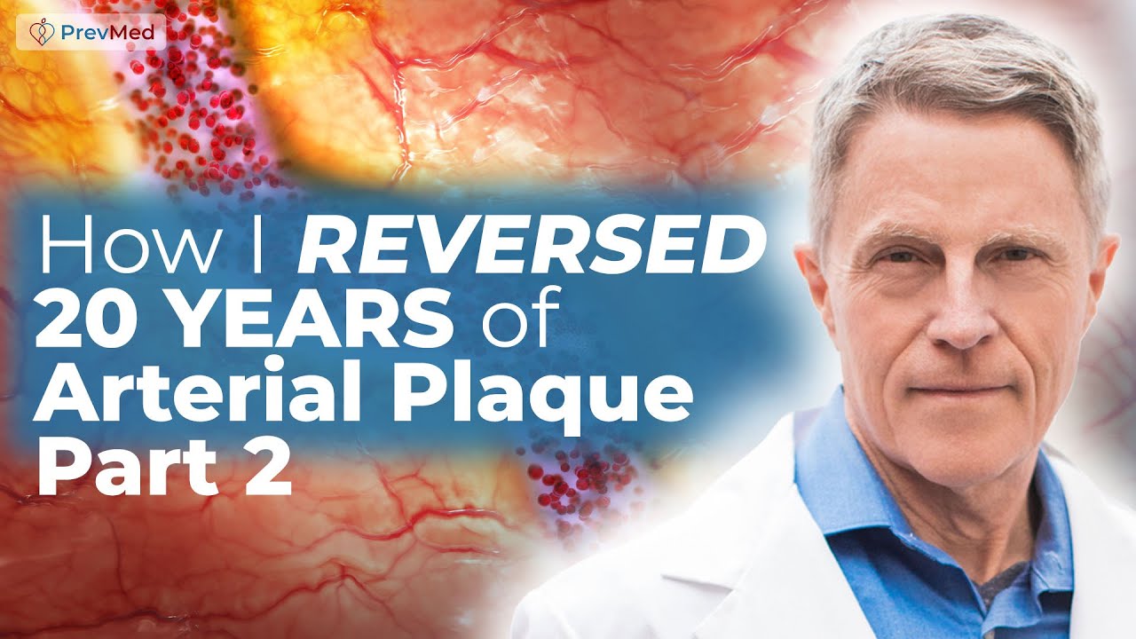 Как я повернул свой артериальный возраст на 20 лет назад (часть 2): мои результаты