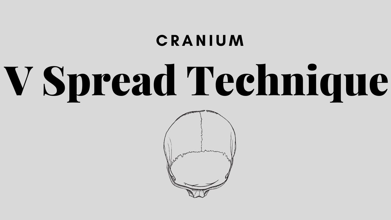V Spread Technique