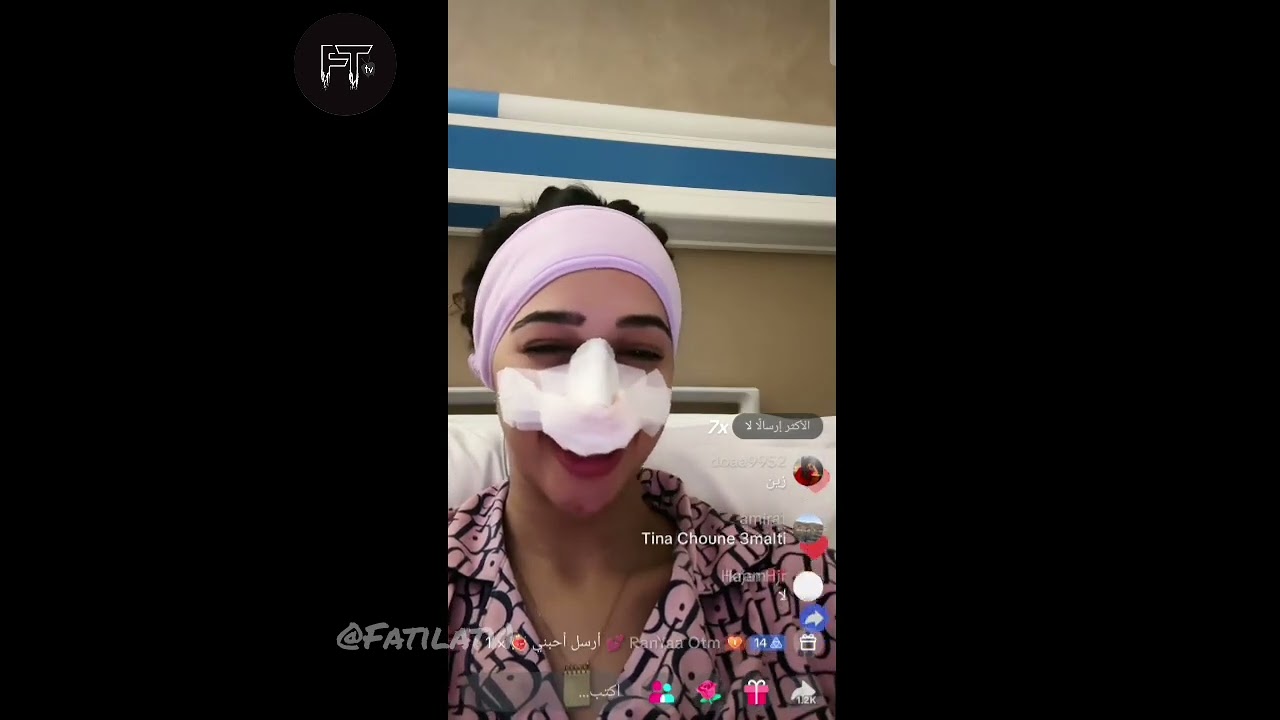 لايف زكية عملت عملية أنف ،اجواء مع المتابعين #فرصة_تانية #قسمة_ونصيب4 