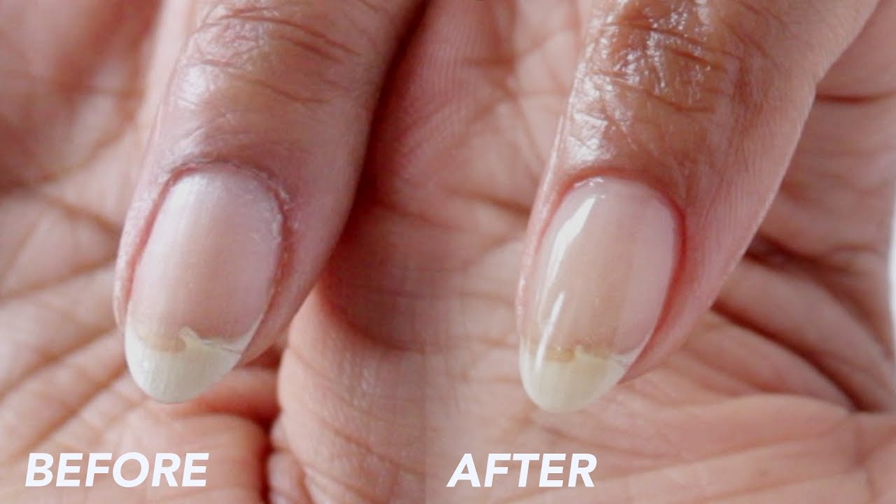 FIX A BROKEN NAIL | Acrylic & Gel Method