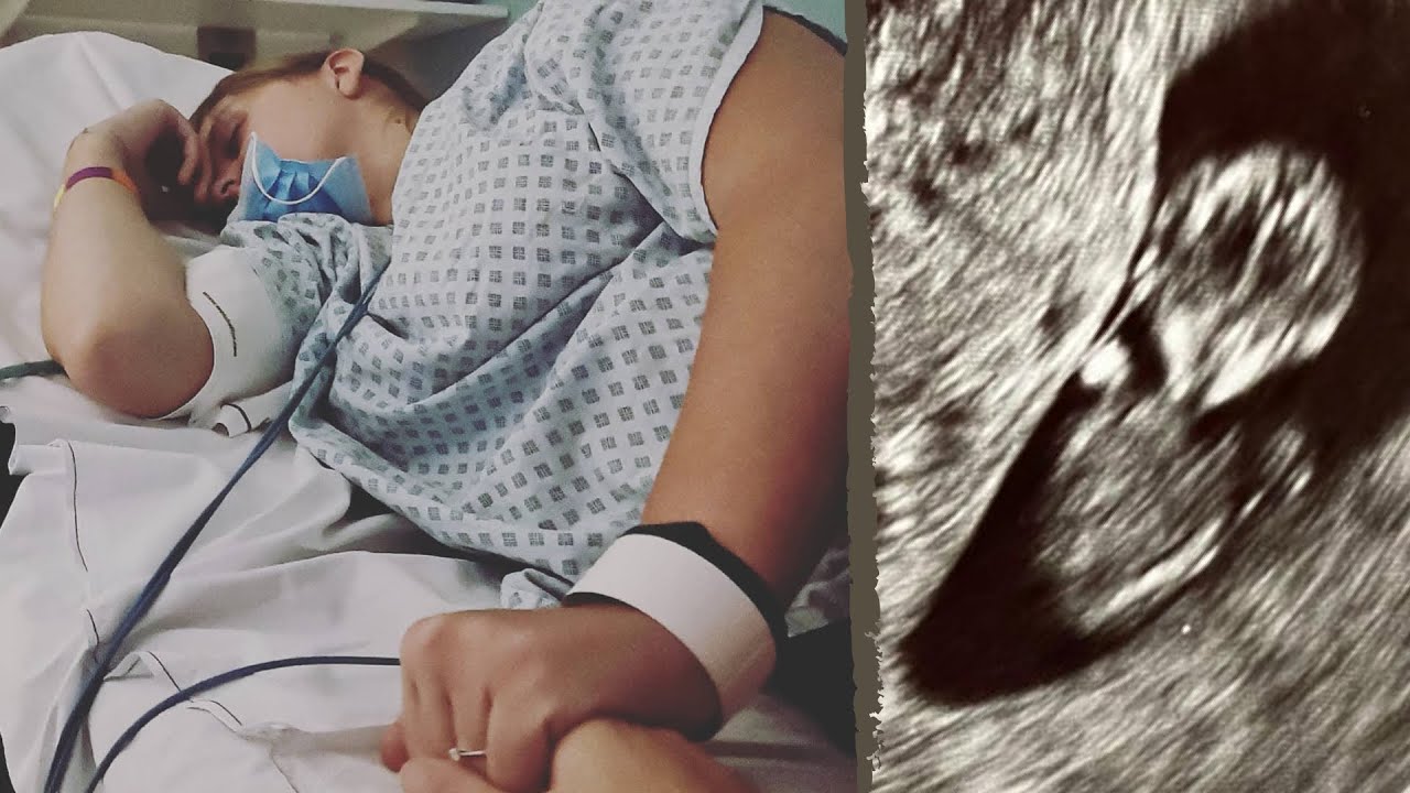 I Was Admitted To Hospital! 😭 (10 Weeks Pregnant) | Lesbian IVF Pregnancy - UK