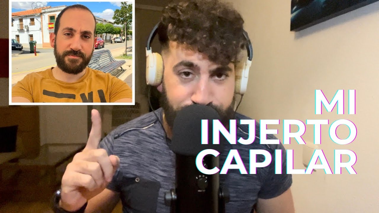 ASMR hablando sobre mi Injerto Capilar [Soft Spoken]