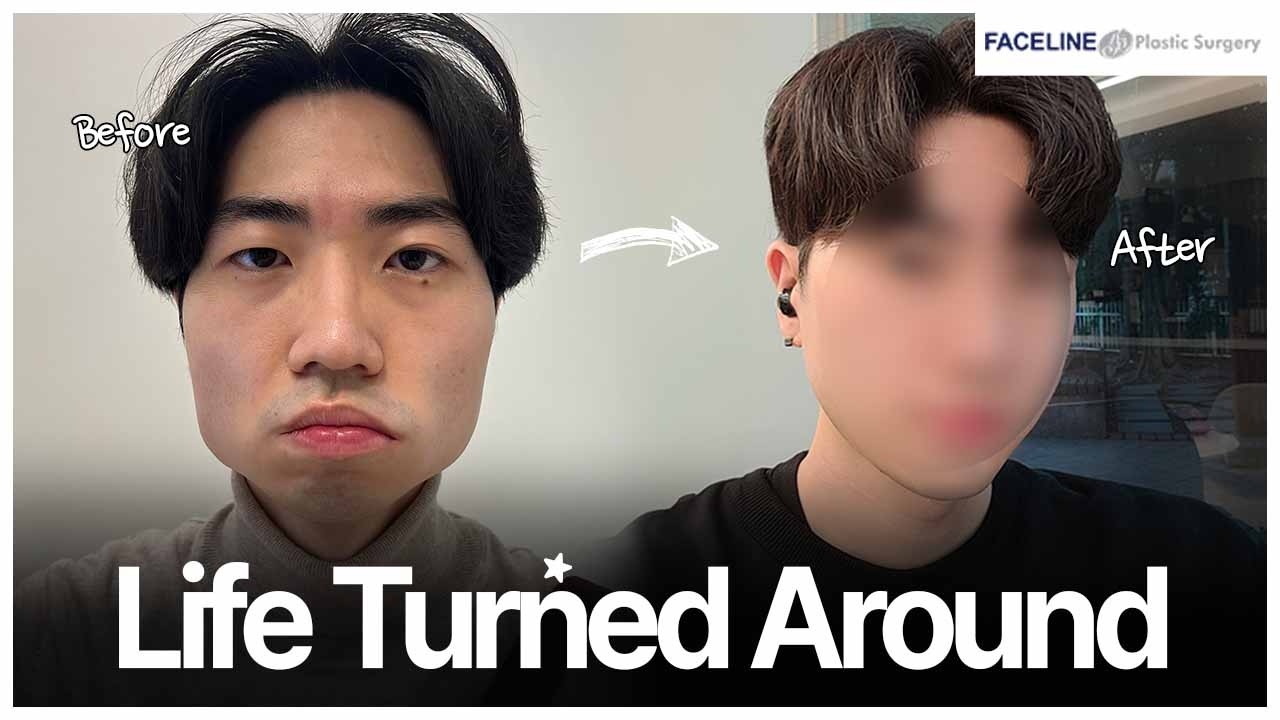 I went all-in on Korean plastic surgery… but everyone says I look the same #Faceline