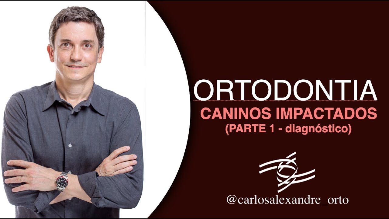 Caninos Retidos (impactados)