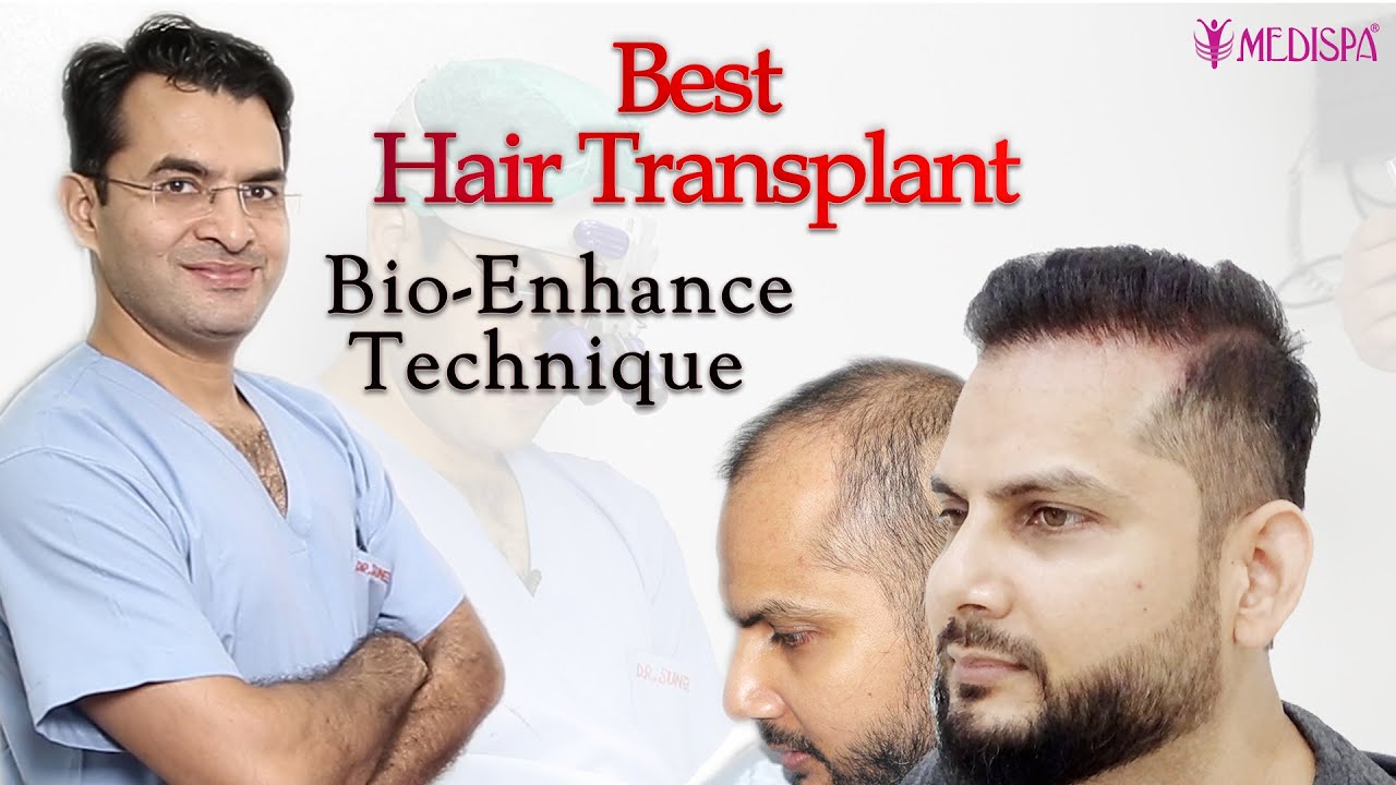 Hair Transplant in Delhi | Best Cost of hair Transplant in Delhi
