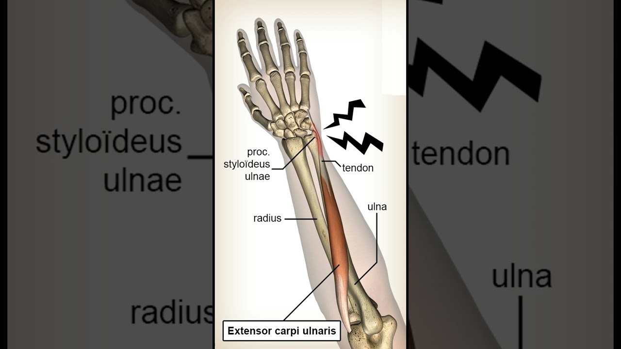 💪 ECU Synergy Test &mdash; Quick Wrist Stability Check! #wristpain #meded #atc #physiotherapy  #ortho
