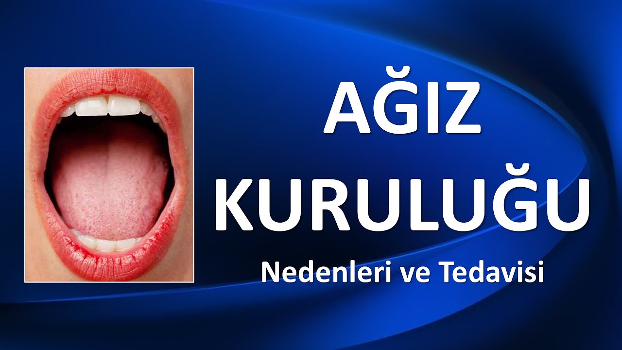 AĞIZ KURULUĞU Nedenleri ve Tedavisi