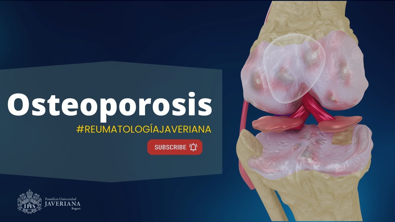 Osteoporosis