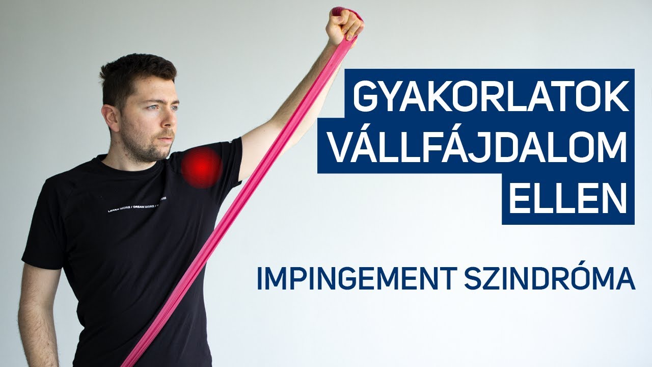 Impingement szindróma kezelése (oka, gyakorlatok, gyógytorna)