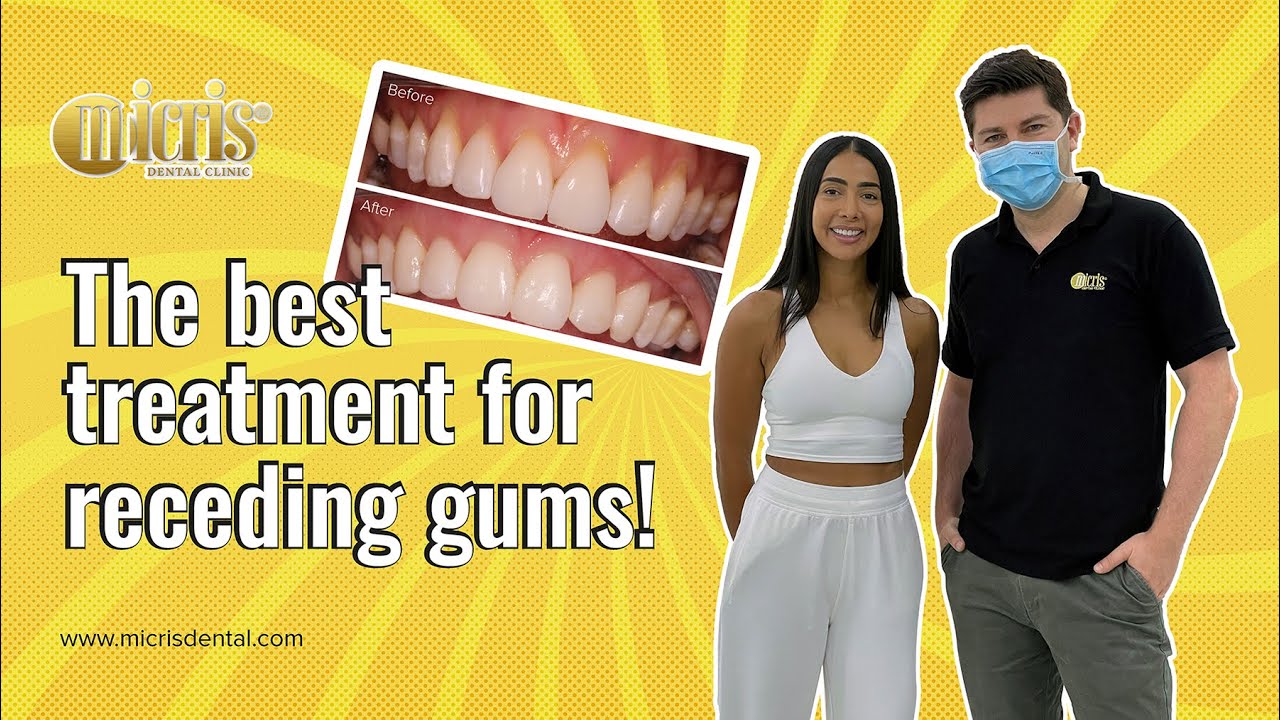 Dr. Khasha Treating Receding Gums in Dubai With the Pinhole Treatment | Happy Patient Testimonial