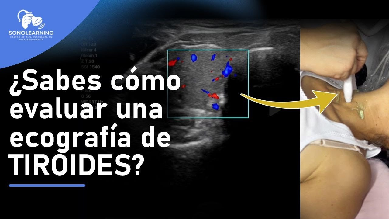 Evaluacion US de la glandula tiroides #tiroides #ecografia #enseñanza #ultrasound #docencia