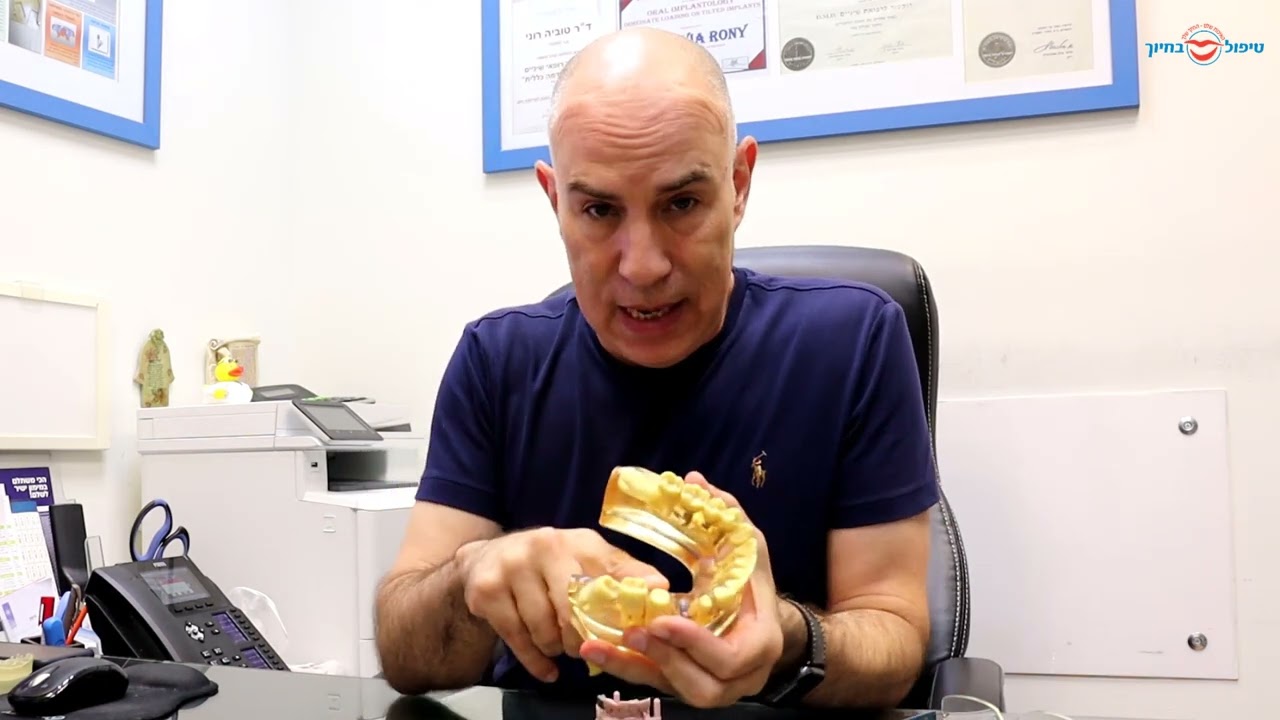 כתרי זירקוניה לעומת כתרים רגילים - מה עדיף?