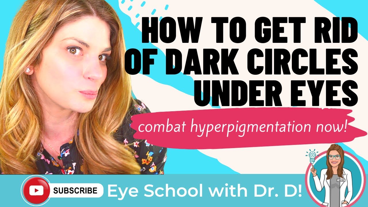 How to Get Rid of Dark Circles | How to Get Rid of Dark Circles Under Eyes | Eye Doctor Explains
