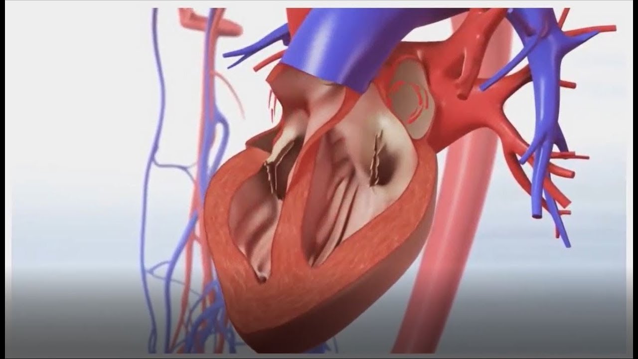 Left Atrial Appendage Closure: State of the Art