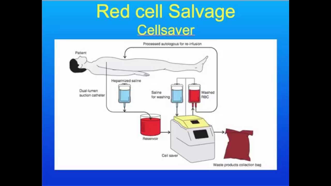 20151019 Blood Conservation and Triggers