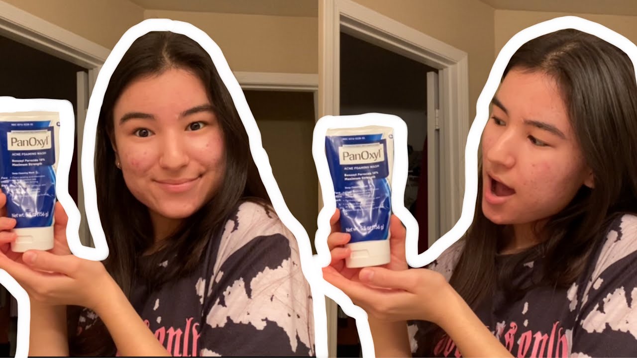 I TRIED PANOXYL FOR 2 WEEKS/ HOW TO GET RID OF ACNE, REDNESS & TEXTURED SKIN?