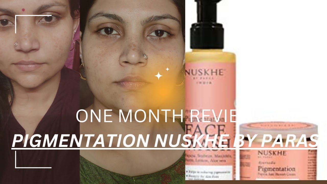 One month challenge review | pigmentation by@ParasTomar @nehavansh