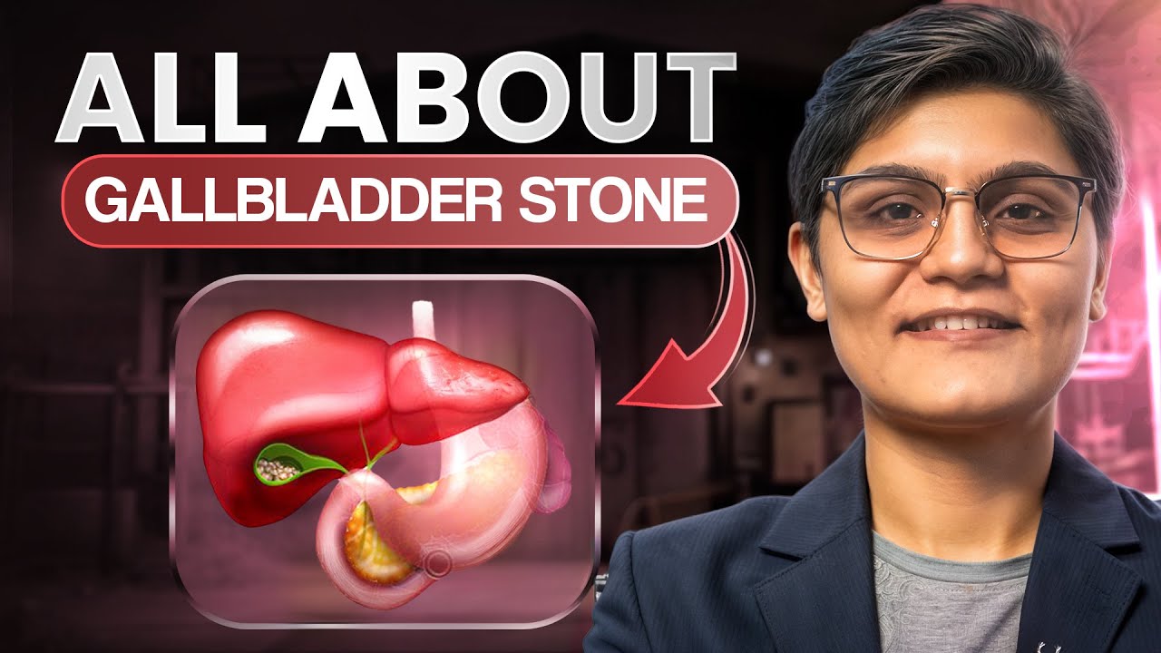 Gallbladder Stone Symptoms, Causes, Tests & Laparoscopic Surgery | Watch Before It’s Too Late
