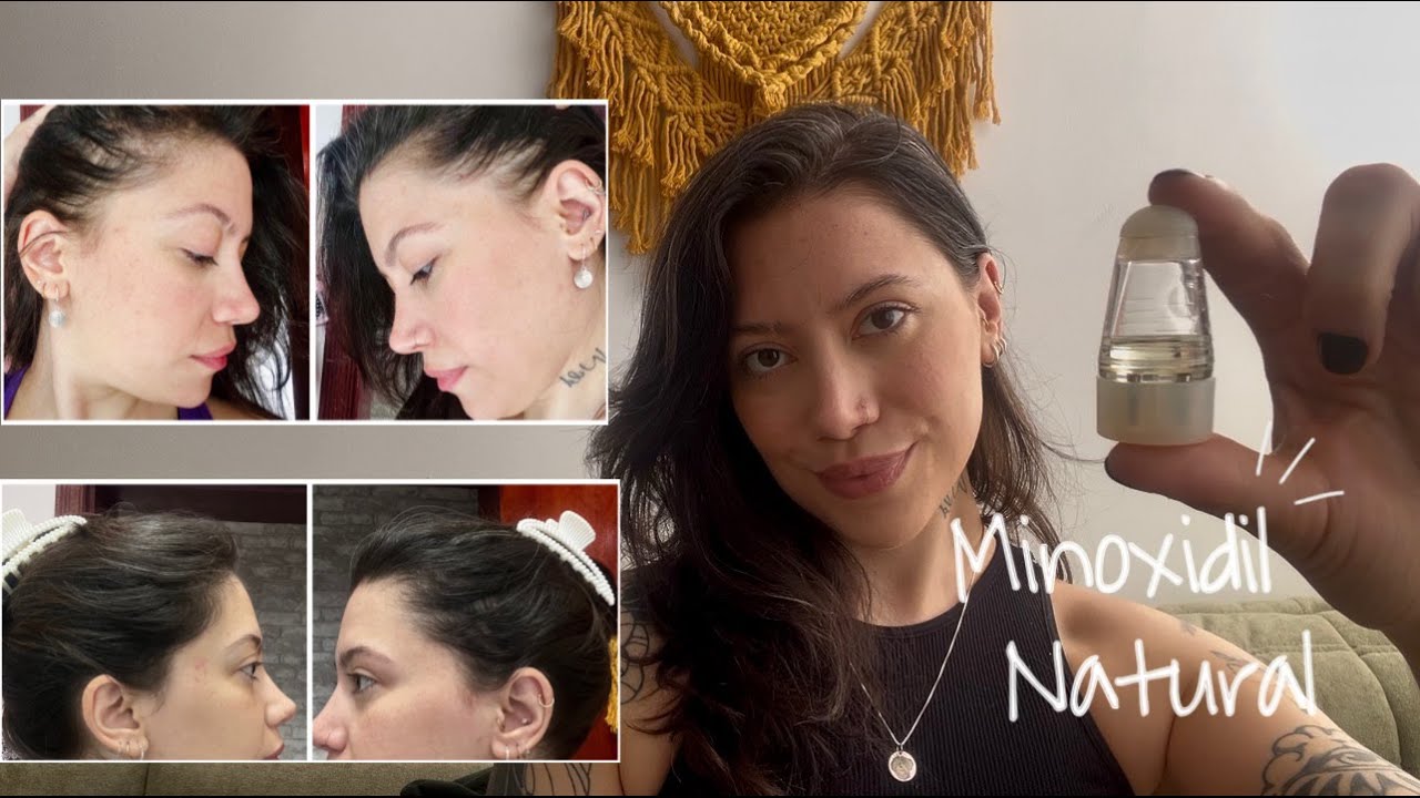 COMO TRATAR A QUEDA DE CABELO DE FORMA NATURAL