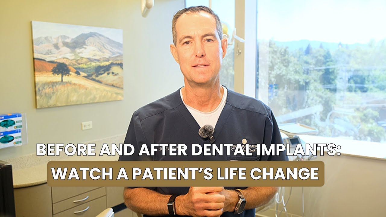 Before-and-After Dental Implants: A Real Smile Transformation Story