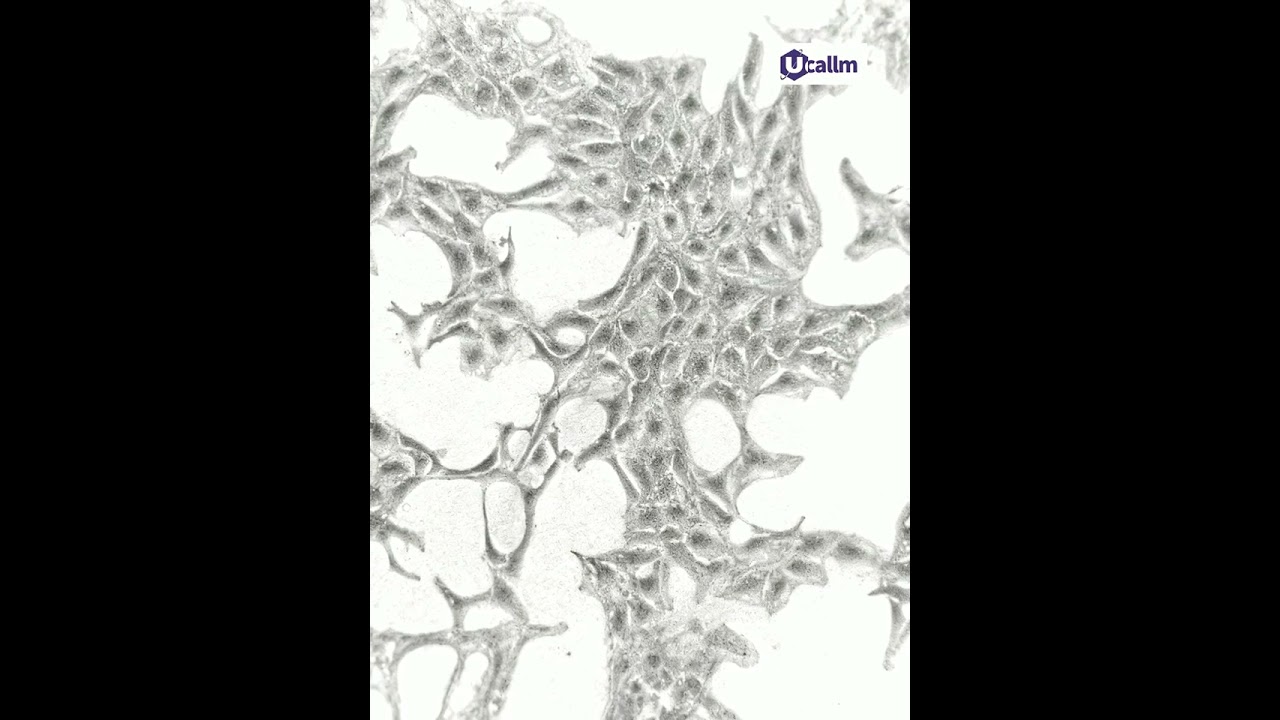 A Guide to Avoiding Pitfalls in Culturing HEK293 Cells