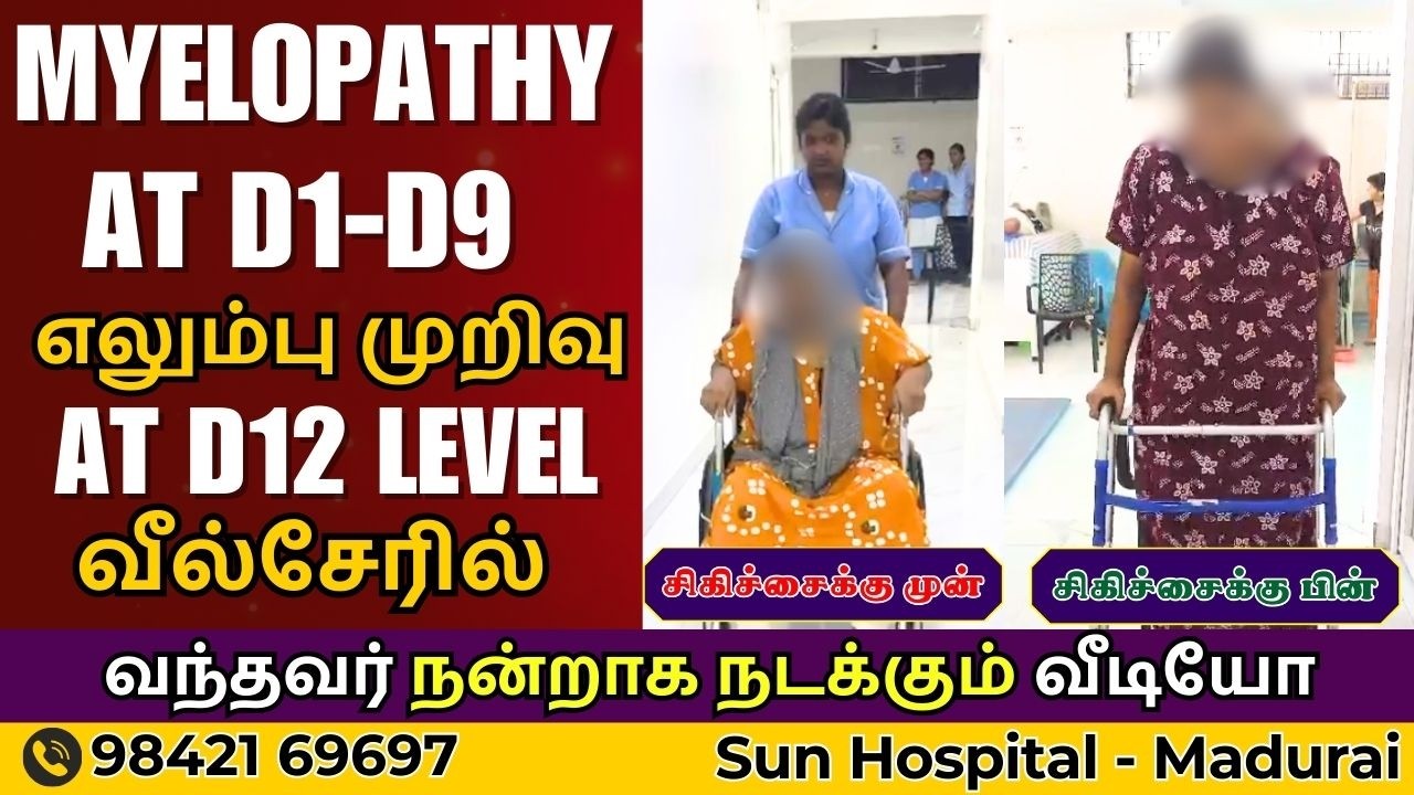 Myelopathy At D1-D9 & எலும்பு முறிவு AT D12 வீல்சேரில் வந்தவர் நன்றாக நடக்கும் வீடியோ | Sun Physio