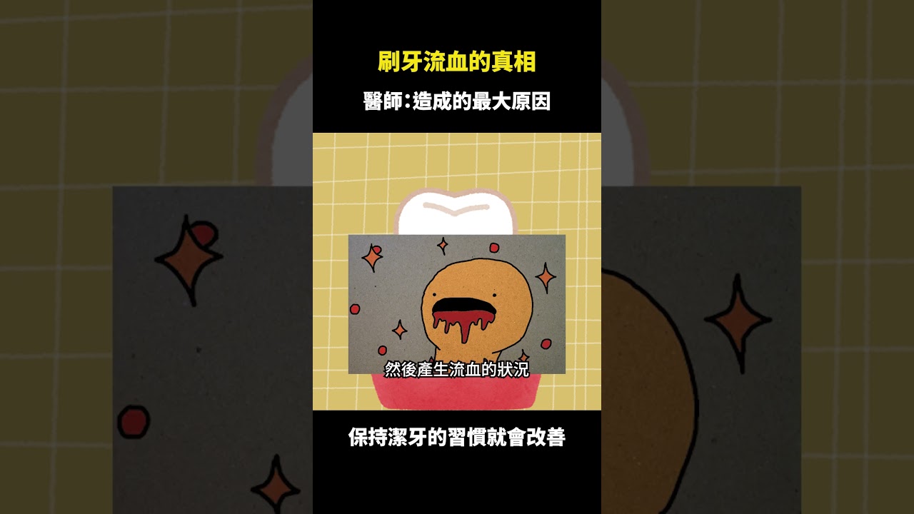你刷牙會流血嗎？刷牙流血的真相就是...！｜【祐民牙醫－隱適美旗艦店】鑽石級楊大為醫師 #刷牙流血 #牙齒 #祐民牙醫 #牙齦發炎