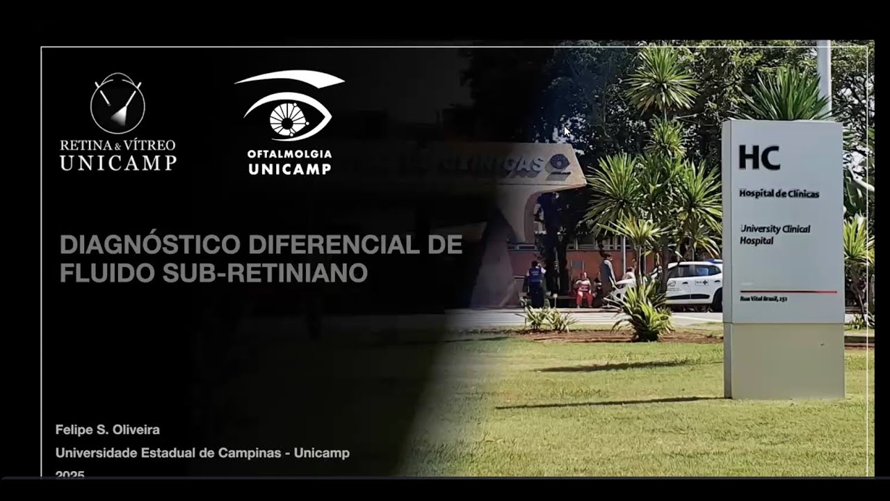Retina e Vítreo (06/11/2025) - Diagnóstico Diferencial de Fluido Sub-Retiniano