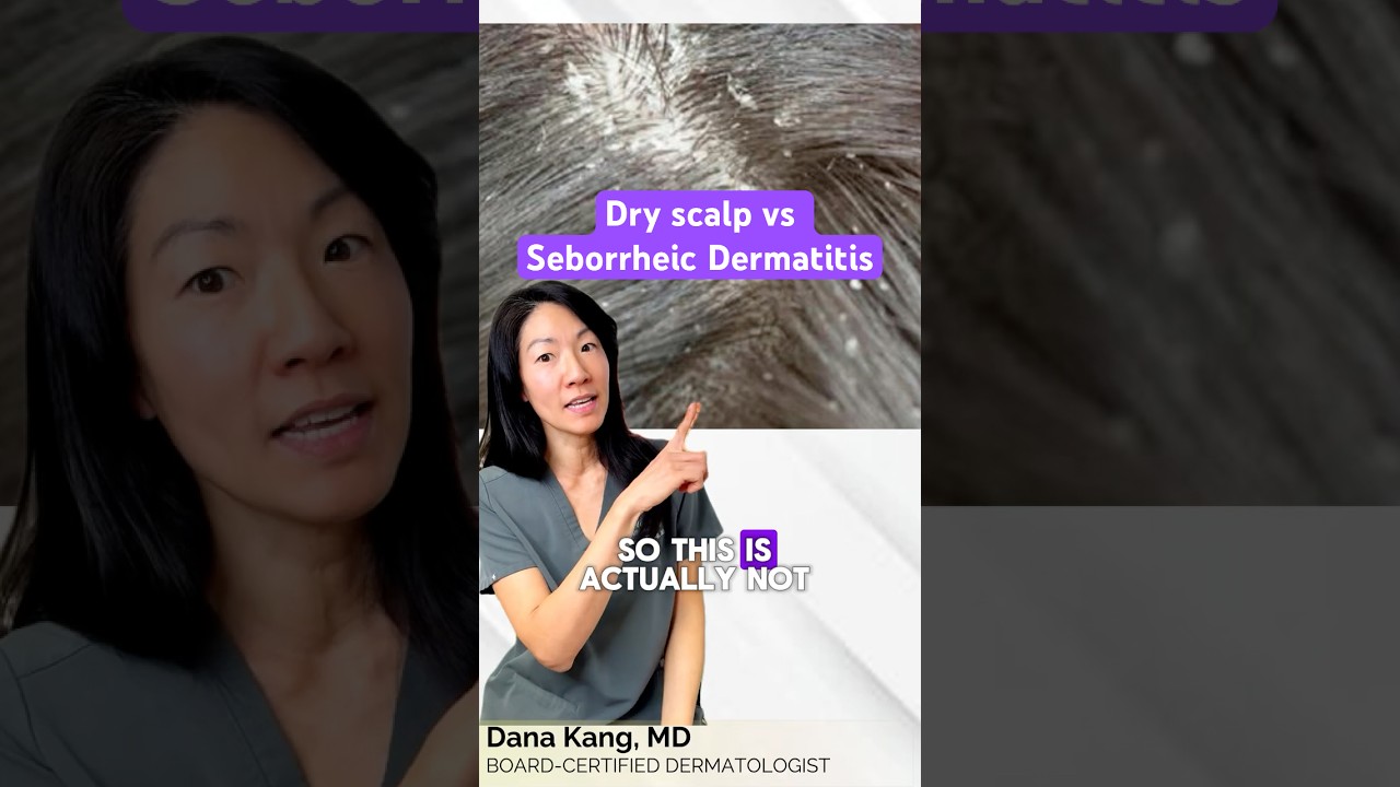 Сухая кожа головы? Возможно, это себорейный дерматит! | Доктор Дана Канг