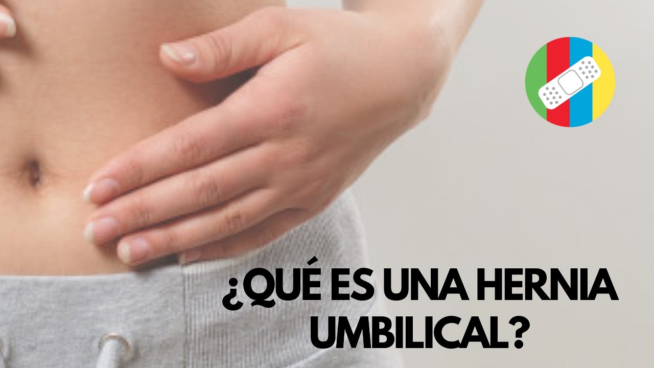 ¿QUÉ ES UNA HERNIA UMBILICAL?