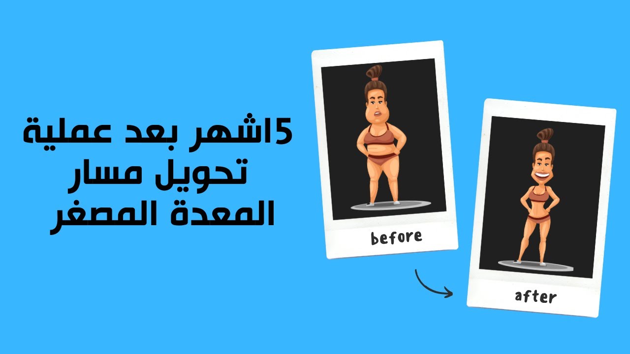 حكايتي مع السمنة