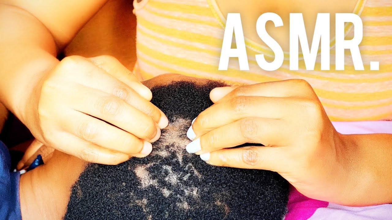 UPCLOSE DANDRUFF SCRATCH || ASMR