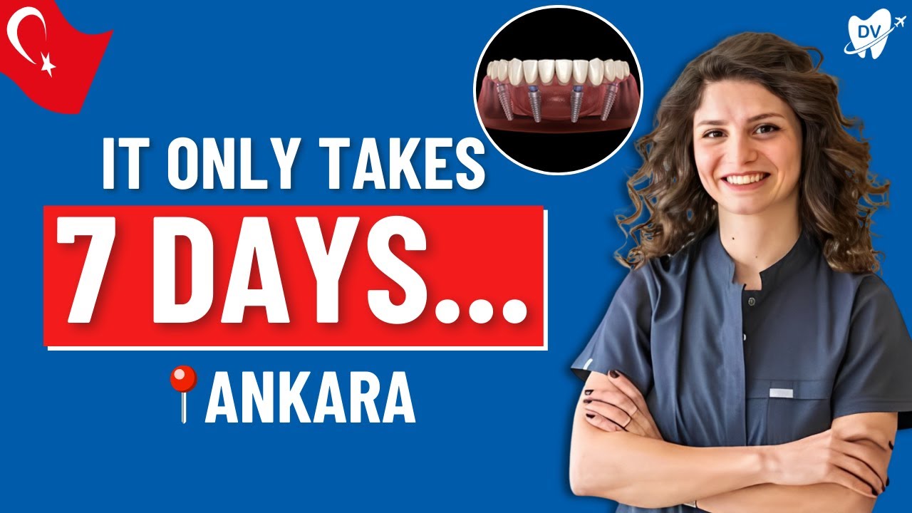 All on 4 Dental Implants in Ankara, Turkey: 2 Steps, 7 Days & Infinite Smiles!