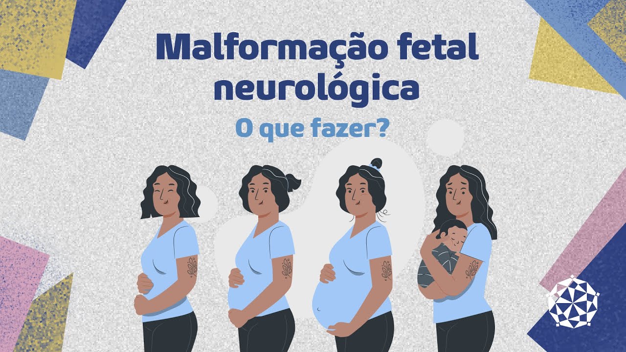 Qual a causa da malforma&ccedil;&atilde;o fetal neurol&oacute;gica?
