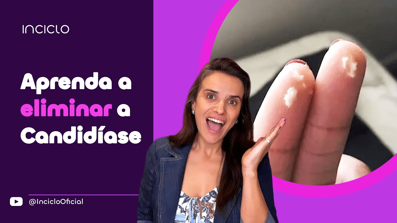 Candidíase Vaginal de Repetição O Que Fazer
