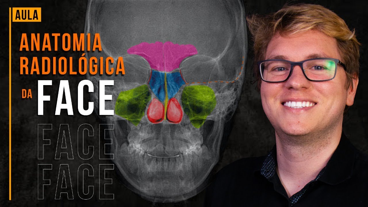 Anatomia Radiológica da Face